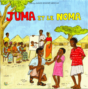 Juma et le noma