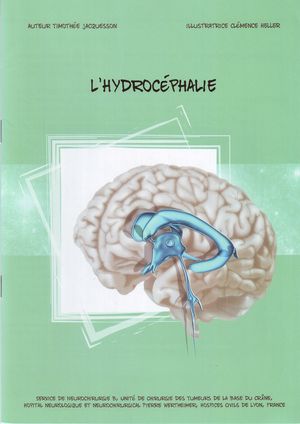 L'hydrocéphalie